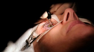women over 50 lasik